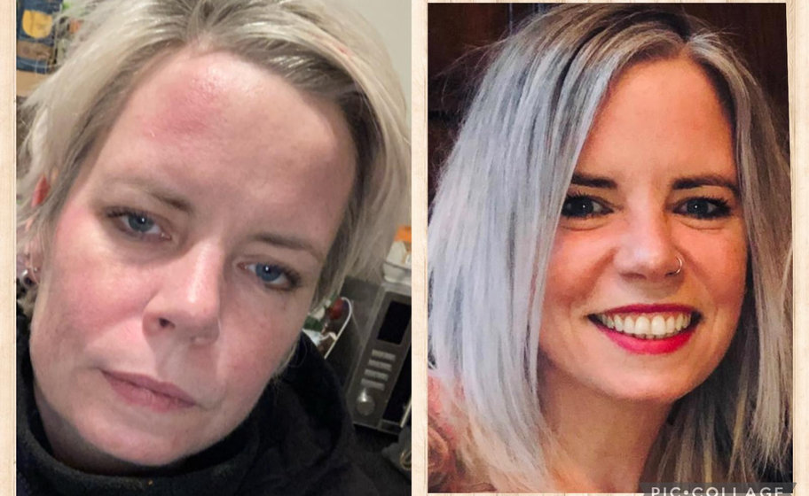 A quiet moment of hope in alcohol recovery